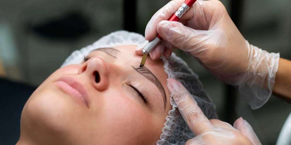 Transform Your Look: Hair Transplant for Fuller Eyebrows