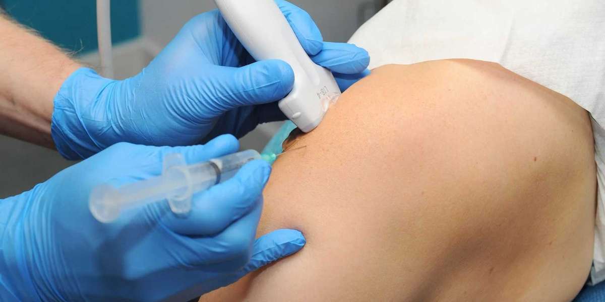 The Importance of Ultrasound Guided Steroid Injections