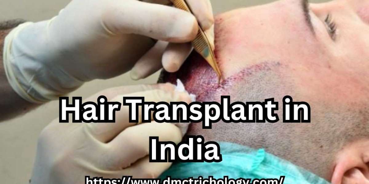 How To Avoid Infection After A Hair Transplant?