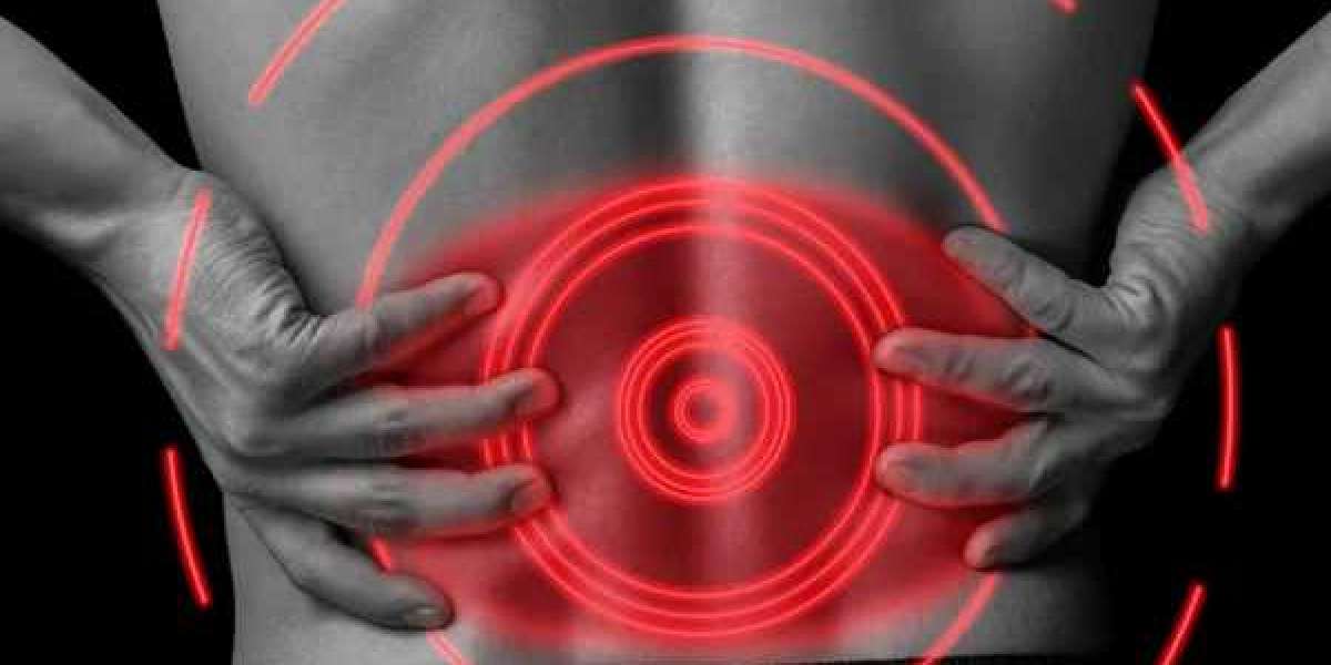 The Ultimate Guide to Back Pain and Bracing