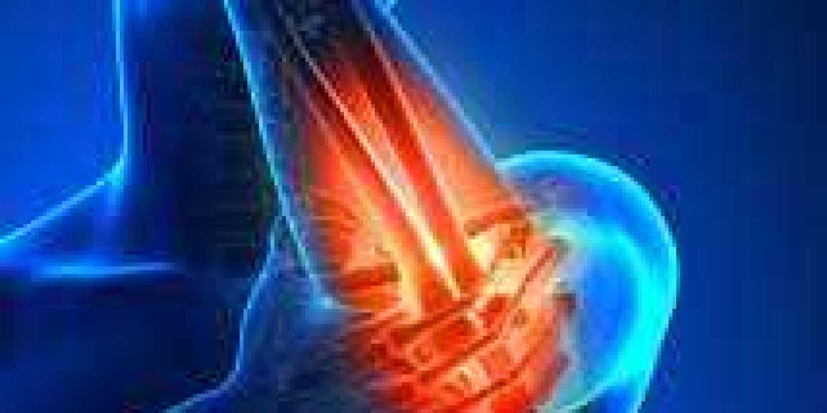 Understanding Joint Pain vs. Nerve Pain