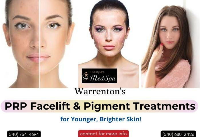 Warrenton's PRP Facelift & Pigment Treatments for Younger, Brighter Skin! - JustPaste.it