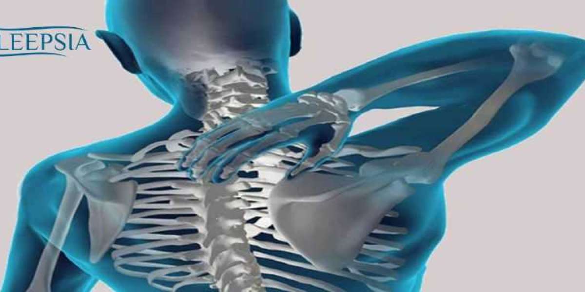 Scoliosis: What it is, Types, Causes, Symptoms and Treatment