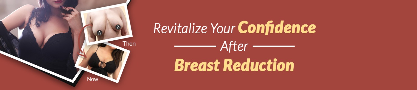 Female Breast Reduction Surgery Cost In Delhi, India