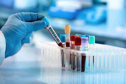 STD Profile Test in Mumbai at Low Cost