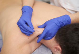 Dry Needling Melbourne: Benefits, Side Effects, and Helps You