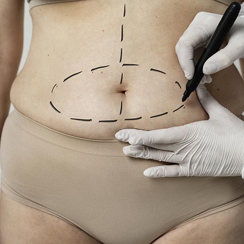 Fat Dissolving Injections: Sculpt Your Beauty with Expert Care