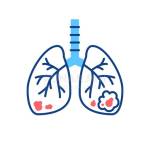 Lung Cancer